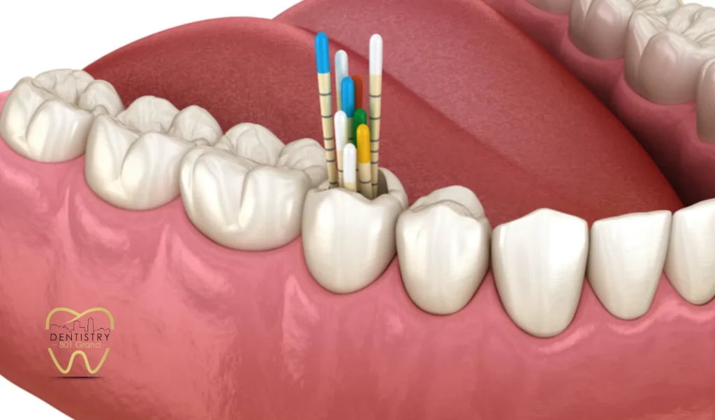 Root Canal vs Extraction: What Each Option Does
